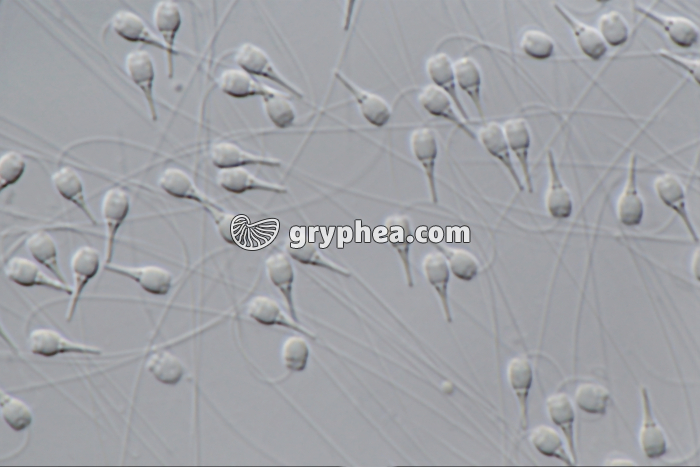 Moule (Mytilus edulis) - Spermatozoïdes x400 - gryphea.org